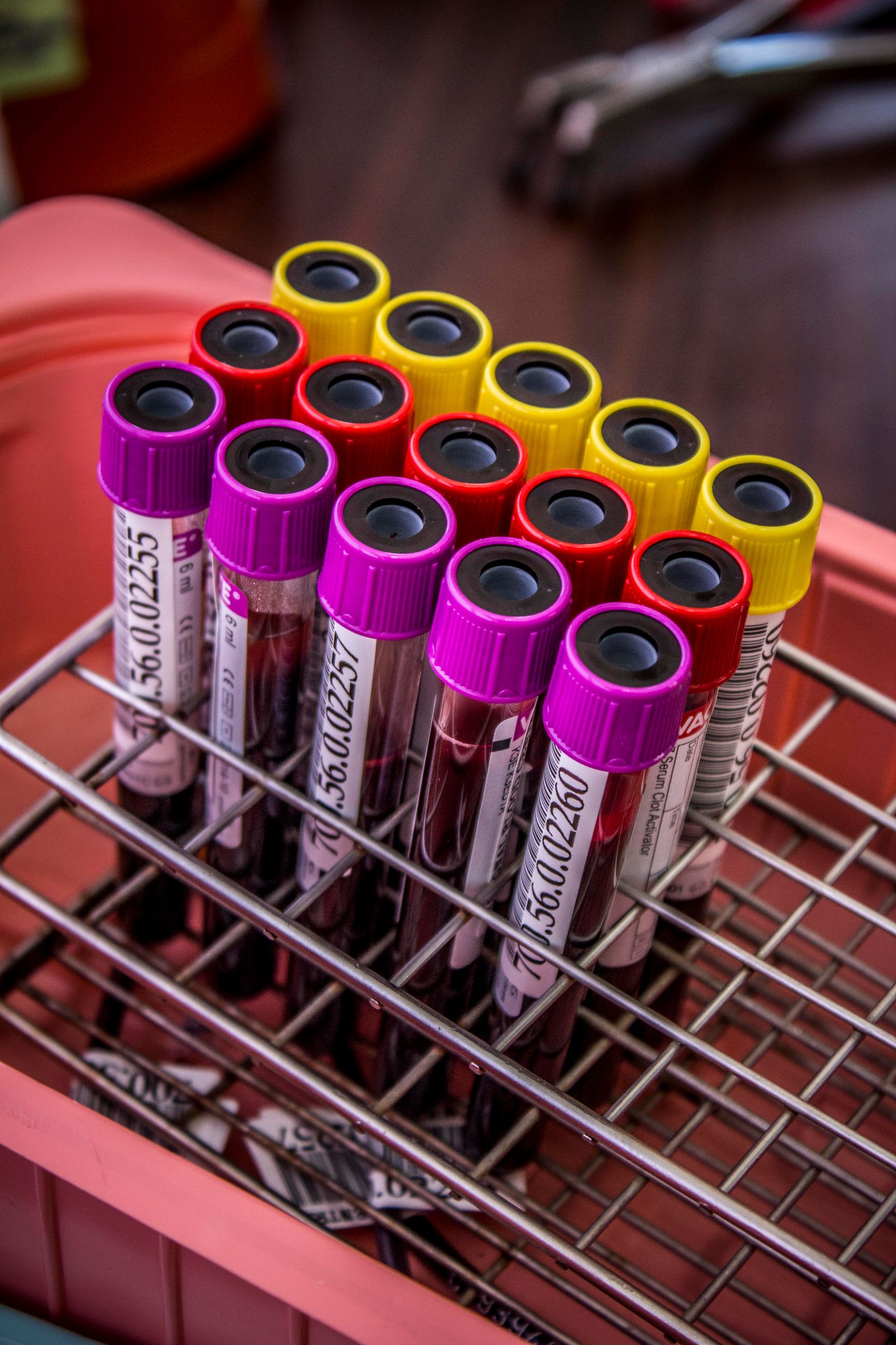 Blood test tubes in a metal rack for laboratory analysis, used for thyroid panels