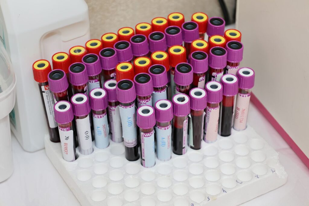 Rows of blood sample vials in a laboratory rack